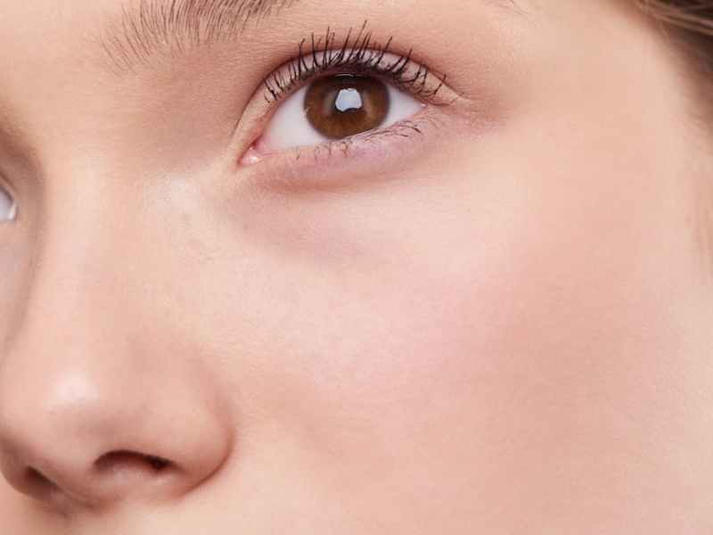 The Aesthetic Edit: The liquid nose job that looks so natural, no one will know (unless you tell&nbsp;them)